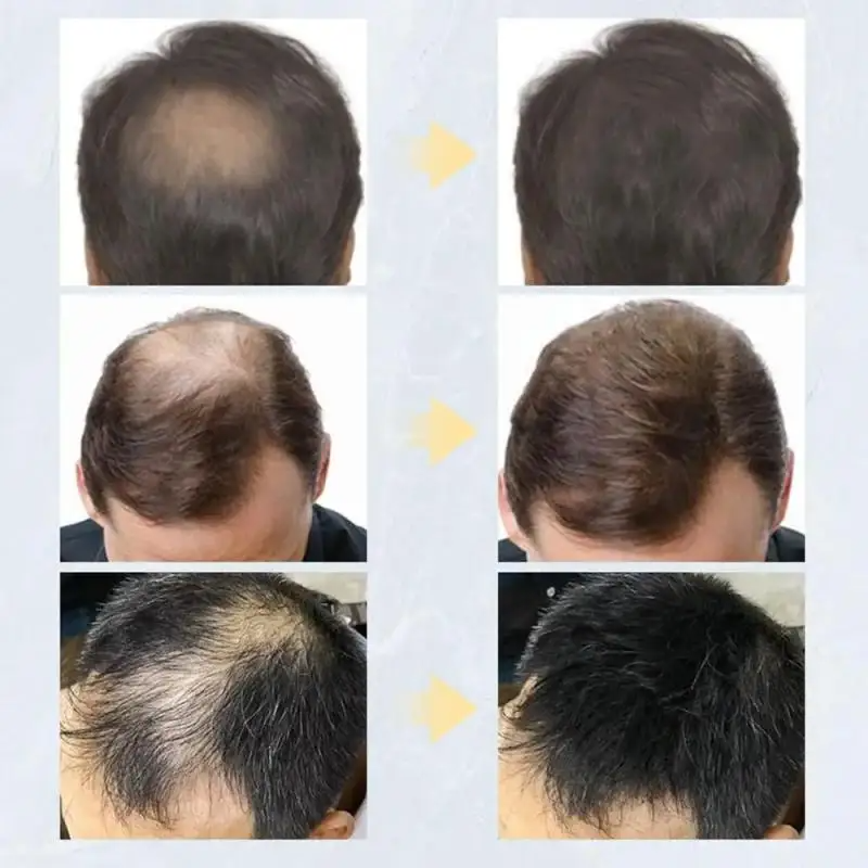 Toppik™ - Polvo de Queratina (Corrector para la Pérdida de Cabello y Barba)