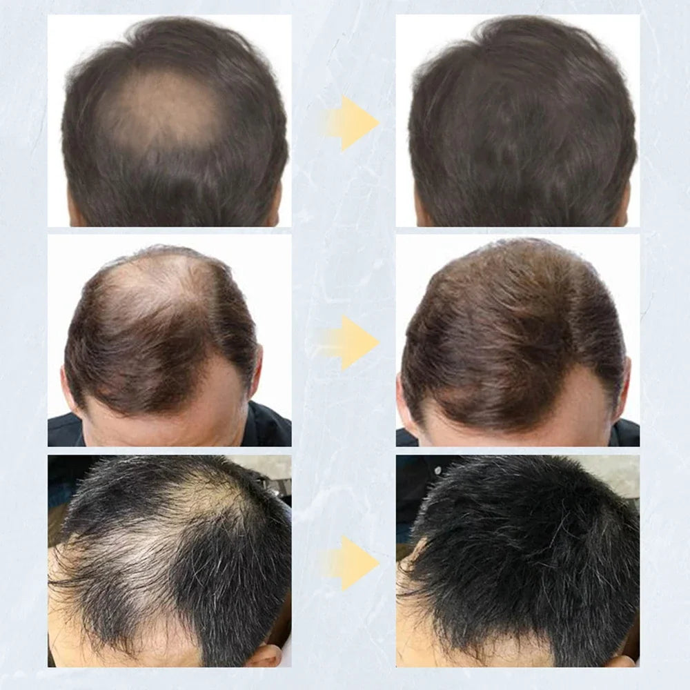 Toppik™ - Polvo de Queratina (Corrector para la Pérdida de Cabello y Barba)