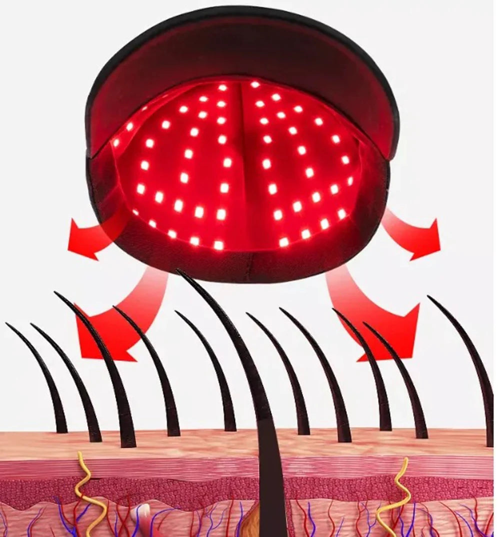 HairNova Cap™ (Terapia Capilar LED)